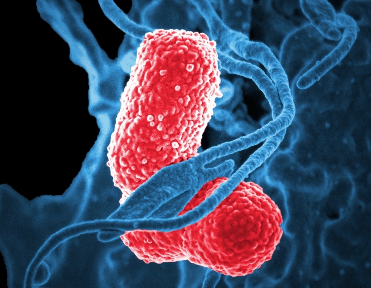 全球第42位！巴塞尔大学流行病学专业简介
