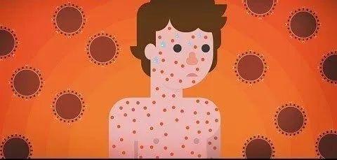 美国留学打疫苗多少钱一针免费吗,最新最靠谱的美国留学疫苗全攻略(图1)