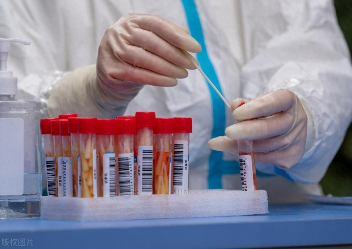 公派访学的三种方式究竟哪个更合适,最详细的公派出国留学方式解析(图3)